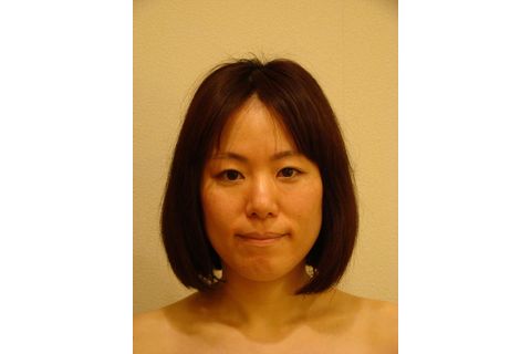 施術前の写真