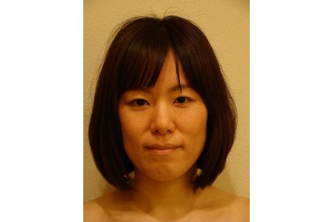 施術前の写真