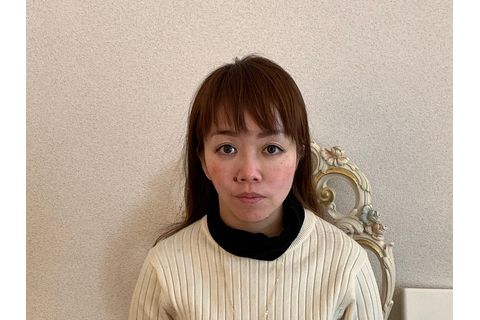 ビフォアアフター