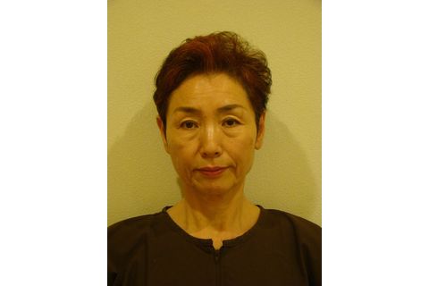 ビフォアアフター１